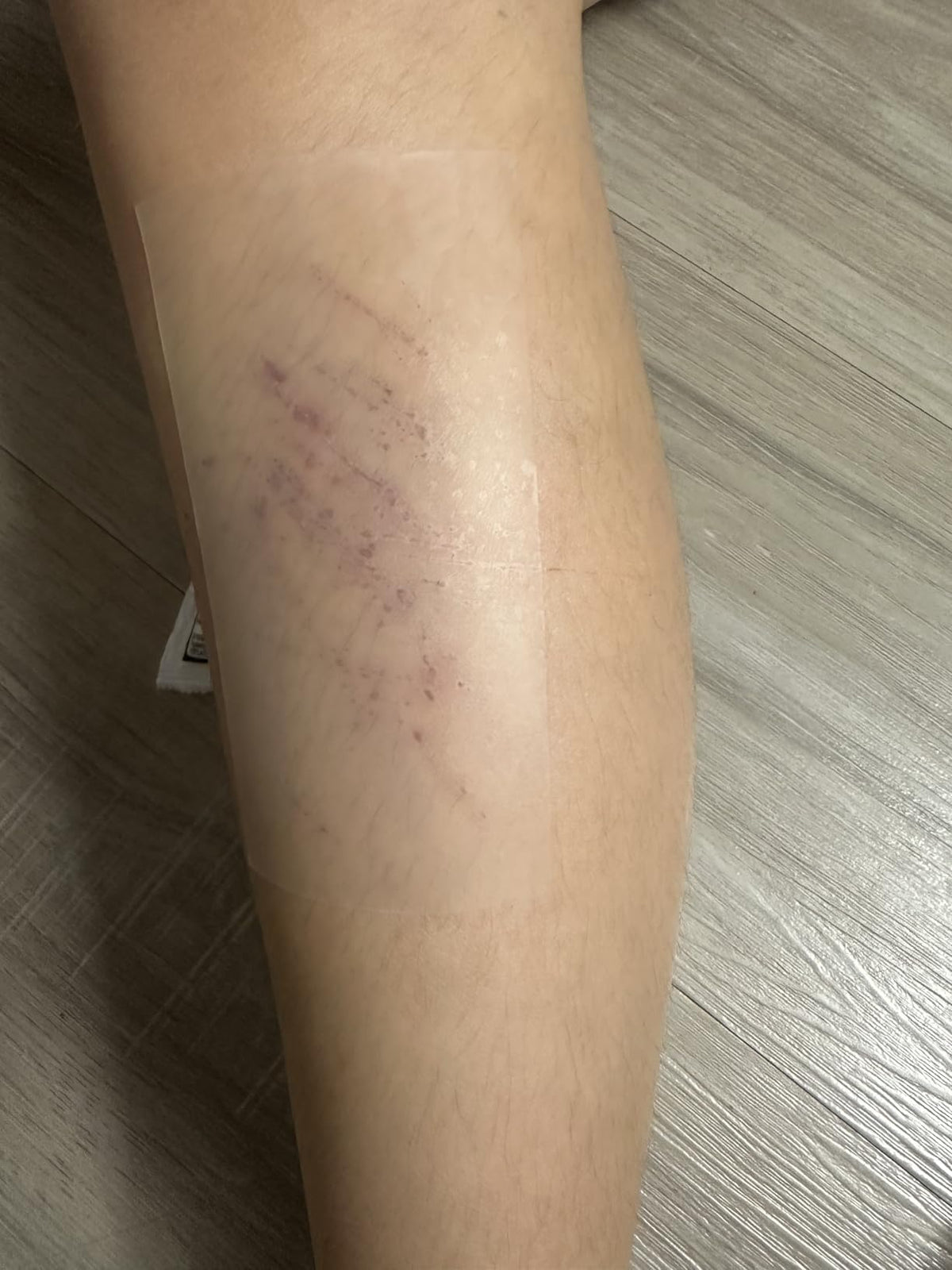 Medical -Grade Hydrocolloid Roll image Medical -Grade Hydrocolloid Roll