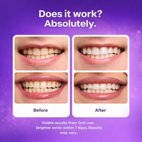 LumeoBay™ Purple Whitening Strips – At-Home Teeth Brightening