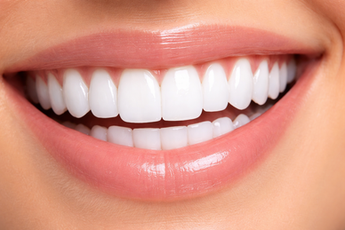 Transform Your Teeth Whitening Habit